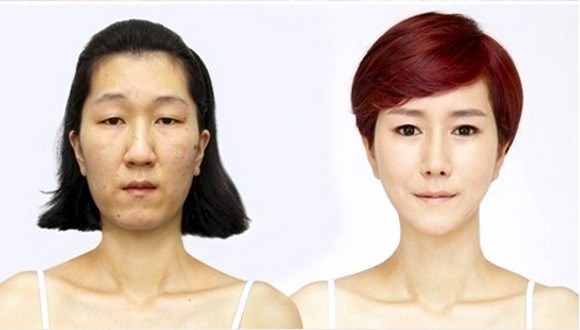 韓國&ldquo;大媽臉&rdquo;女子整容后變美女【圖】